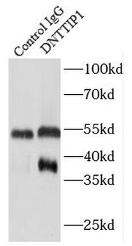 DNTTIP1 Antibody
