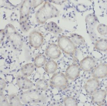 DOCK8 Rabbit Polyclonal Antibody