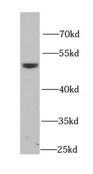 DOK1 Rabbit Polyclonal Antibody