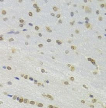DOK1 Rabbit Polyclonal Antibody