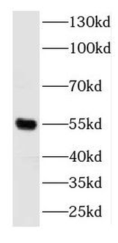 DOK3 Rabbit Polyclonal Antibody