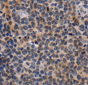DOK3 Rabbit Polyclonal Antibody