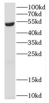 DPH2 Rabbit Polyclonal Antibody