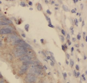 DPH2 Rabbit Polyclonal Antibody