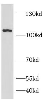 DPP4 Rabbit Polyclonal Antibody