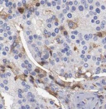 DPP4 Rabbit Polyclonal Antibody
