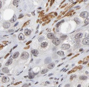DPP8 Rabbit Polyclonal Antibody
