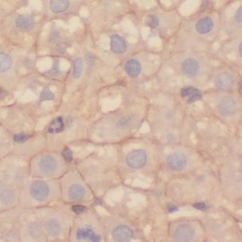 DPYS Rabbit Polyclonal Antibody