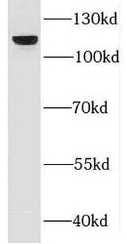 DBN1 Antibody
