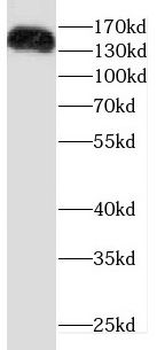 DROSHA Antibody