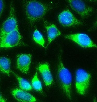 DNM1L Rabbit Polyclonal Antibody