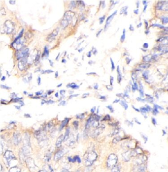 DNM1L Rabbit Polyclonal Antibody