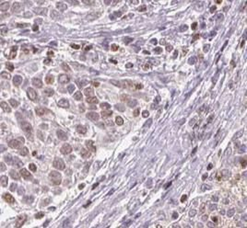SEM1 Antibody