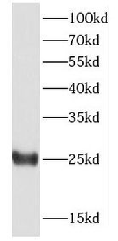 DTD1 Antibody