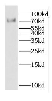 DTL Rabbit Polyclonal Antibody