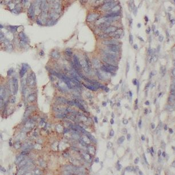 DTX1 Antibody