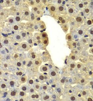 DTX2 Rabbit Polyclonal Antibody