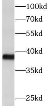 DTX3 Rabbit Polyclonal Antibody