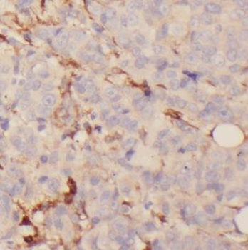 DUS3L Rabbit Polyclonal Antibody