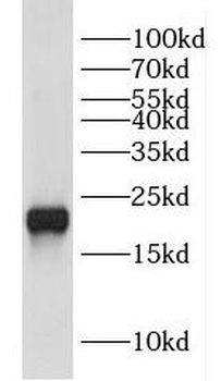 DUSP22 Antibody