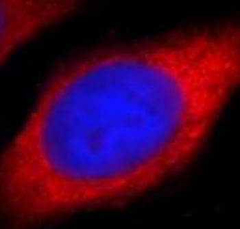 DVL2 Antibody