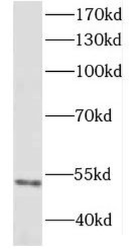 DCTN2 Rabbit Polyclonal Antibody