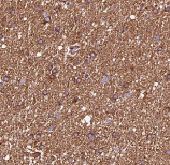 DCTN2 Rabbit Polyclonal Antibody