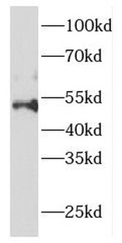 DCTN2 Rabbit Polyclonal Antibody