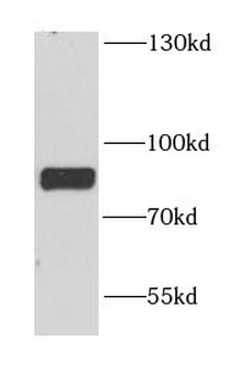 DYNC1I1 Antibody