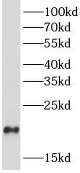 DYNLRB1 Antibody