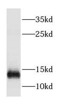 DYNLT3 Rabbit Polyclonal Antibody