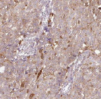DYNLT3 Rabbit Polyclonal Antibody