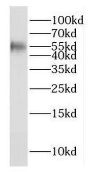 E2F1 Rabbit Polyclonal Antibody