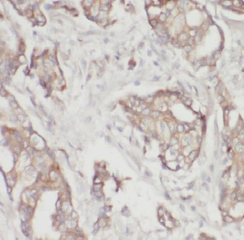 E2F1 Rabbit Polyclonal Antibody