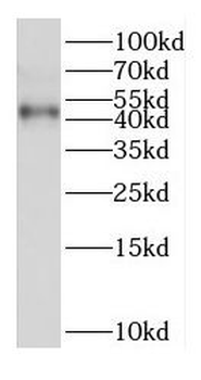 EAF2 Rabbit Polyclonal Antibody