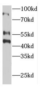 ECM2 Antibody