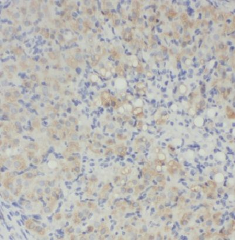 ECM2 Rabbit Polyclonal Antibody