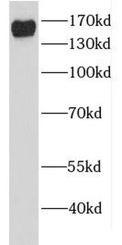 EDC4 Antibody