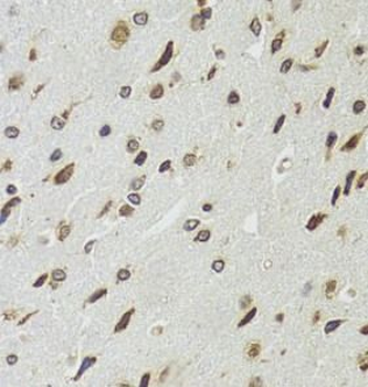 EDF1 Rabbit Polyclonal Antibody
