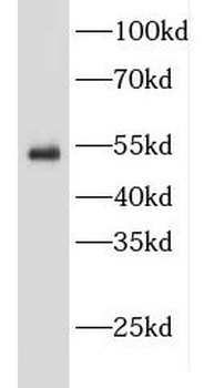 EDNRB Antibody