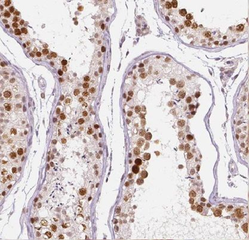 EDRF1 Rabbit Polyclonal Antibody