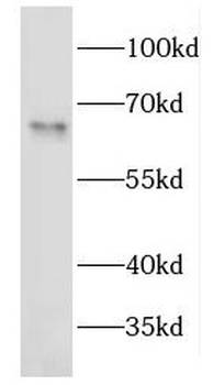 EEPD1 Antibody