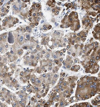 EFCAB5 Rabbit Polyclonal Antibody