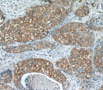 EGFR Rabbit Polyclonal Antibody