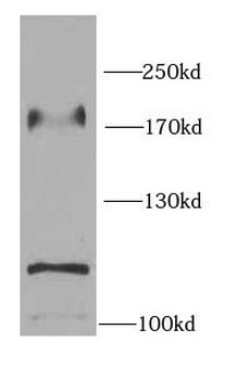 EGFR Rabbit Polyclonal Antibody
