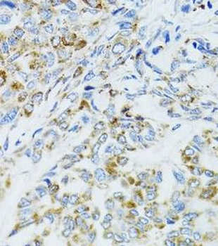 EGFR Rabbit Polyclonal Antibody