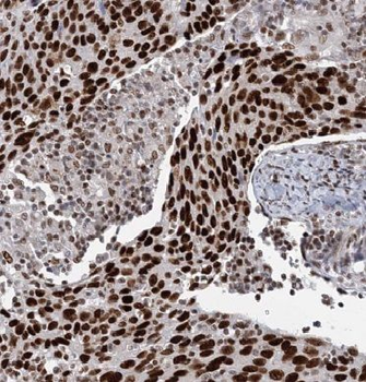 EGR1 Rabbit Polyclonal Antibody
