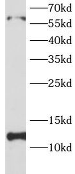 EIF1 Rabbit Polyclonal Antibody