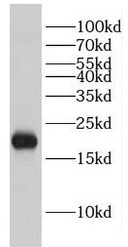 EIF1AX Antibody