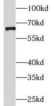 EIF2A Rabbit Polyclonal Antibody